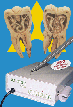 ¡Nuevo Ultratec 6000!